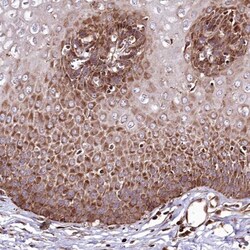 THUMPD3 Antibody, Novus Biologicals:Antibodies:Primary Antibodies